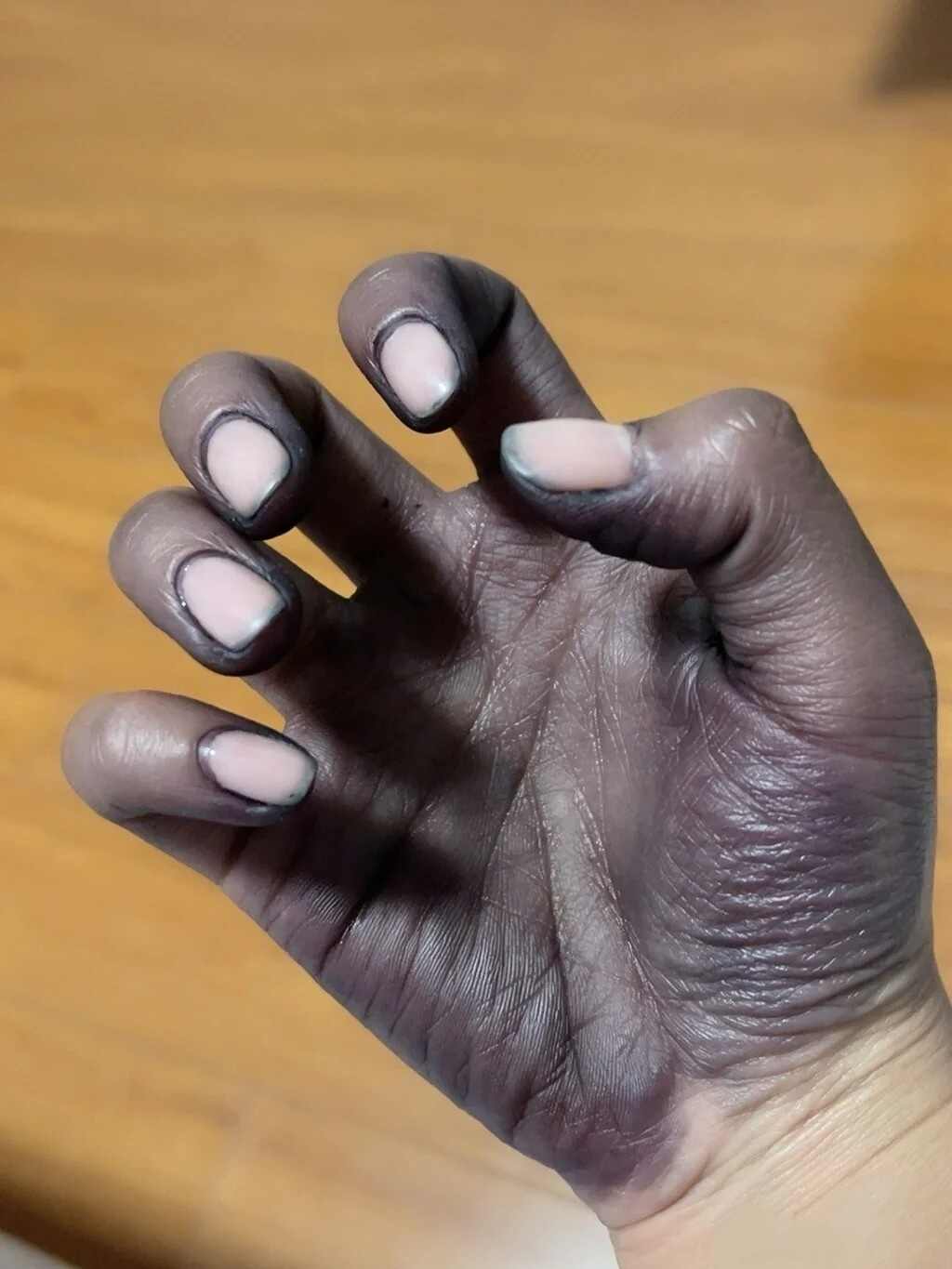 自己染头发把手搞成这样了该怎么去掉啊